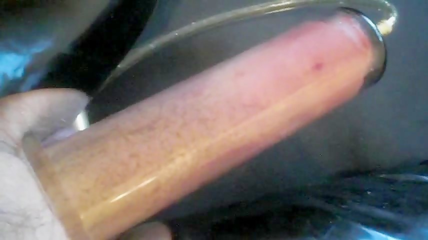 Thumb 20