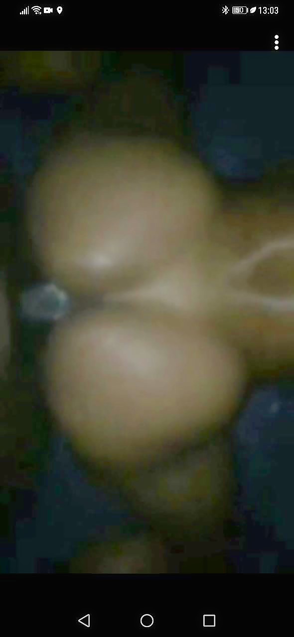 Thumb 11