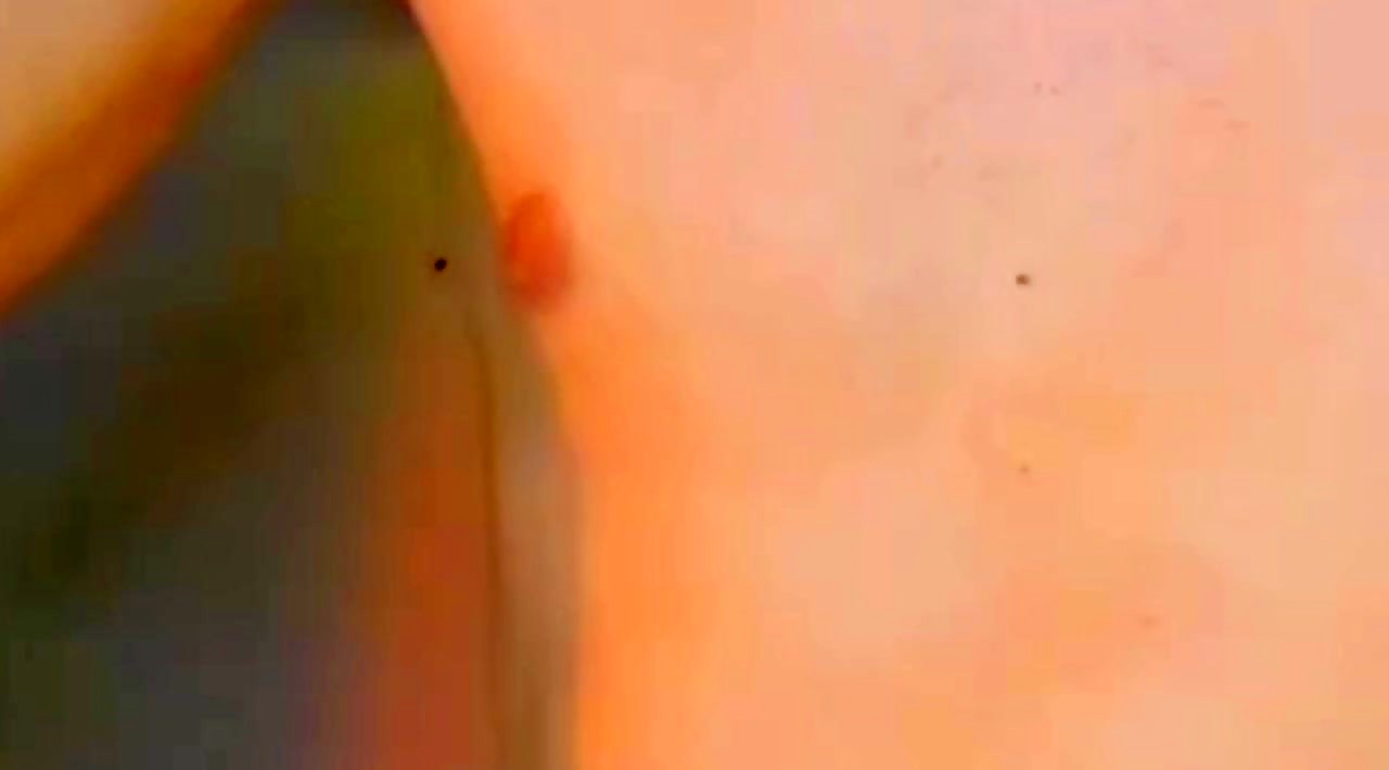 Thumb 20
