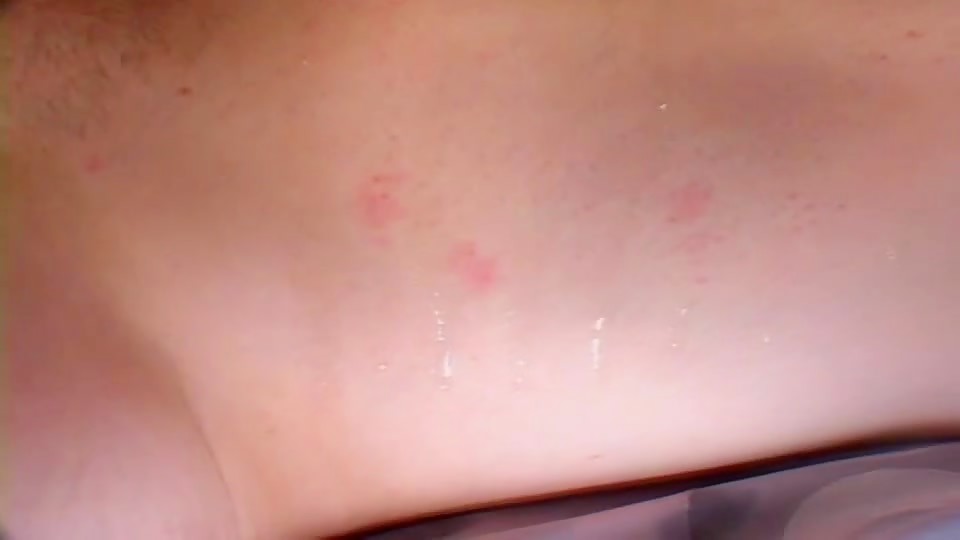 Thumb 19