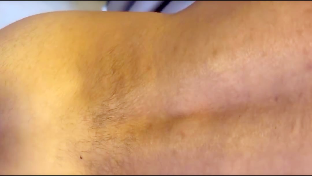 Thumb 10