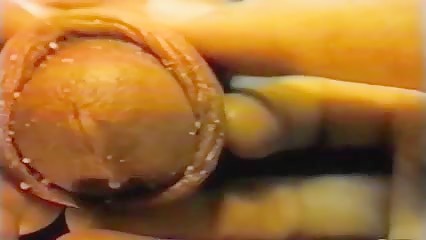Thumb 9