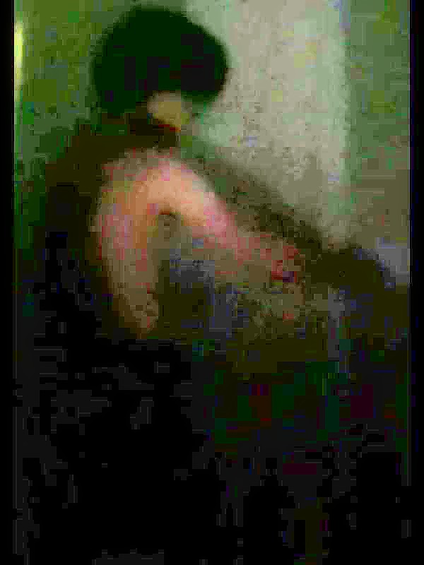 Thumb 9