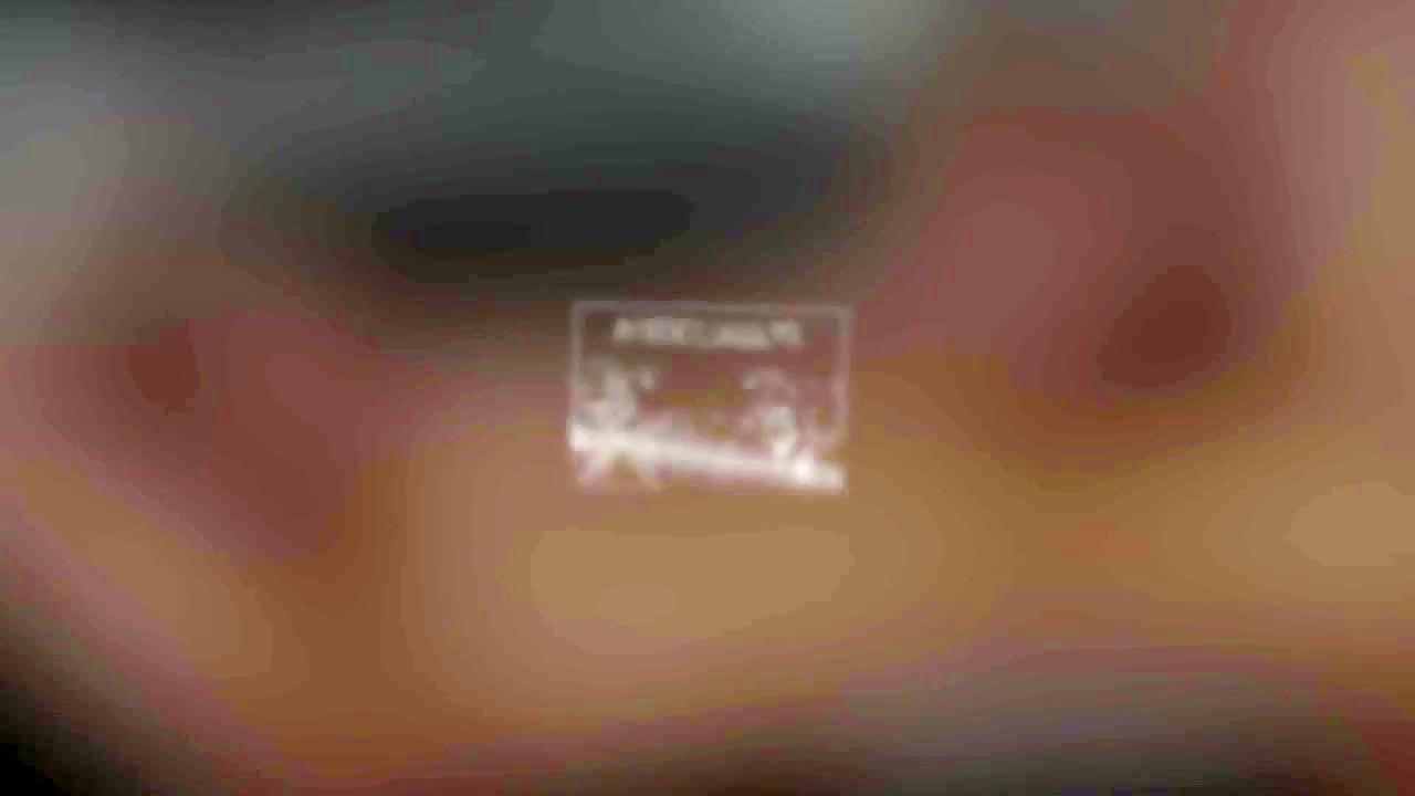 Thumb 20