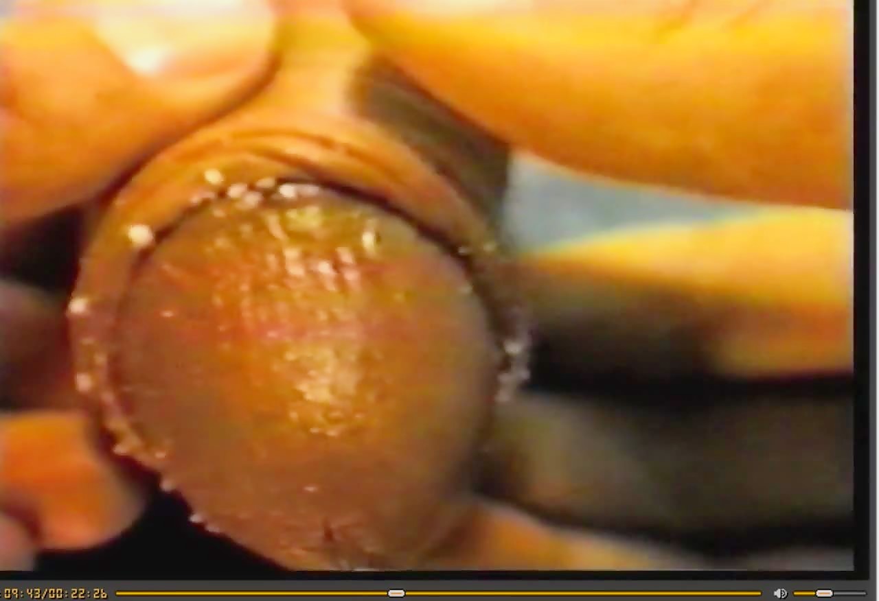 Thumb 13