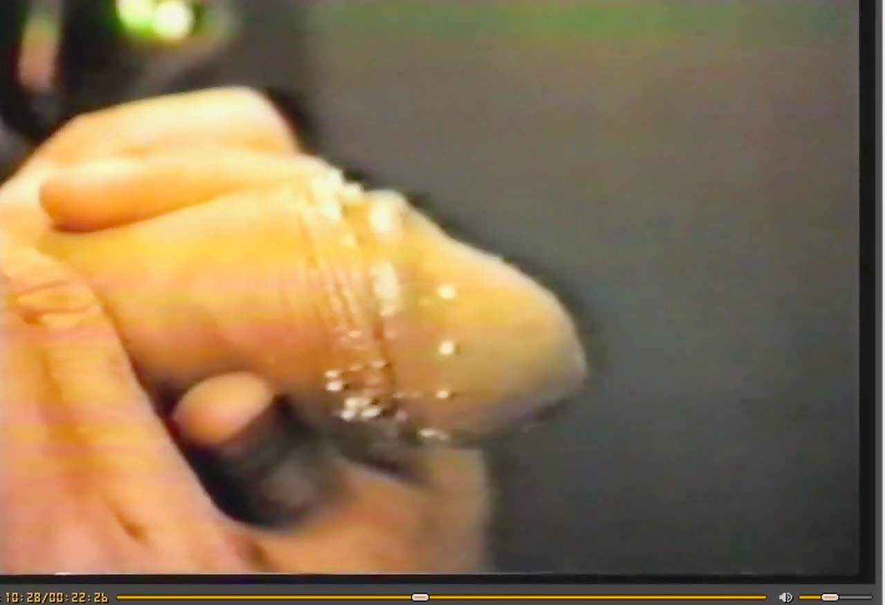 Thumb 14