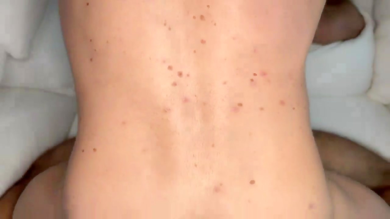 Thumb 12