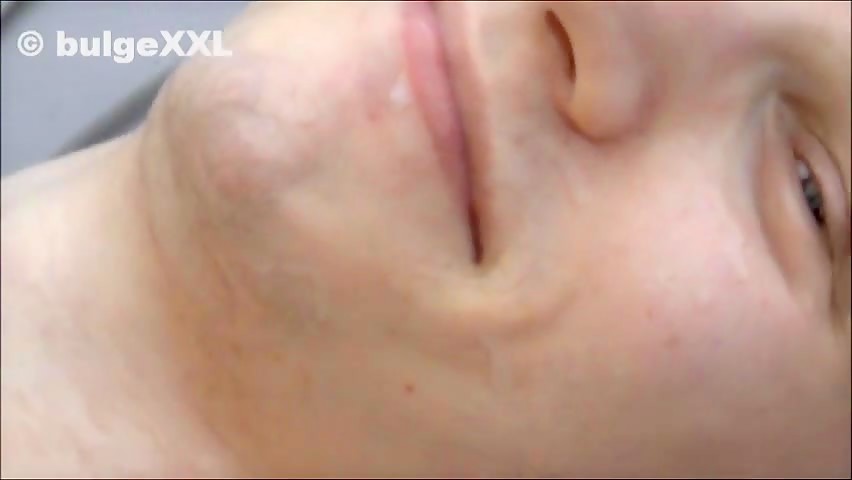Thumb 19