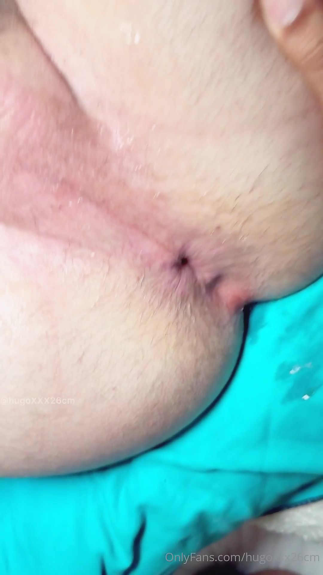 Thumb 20