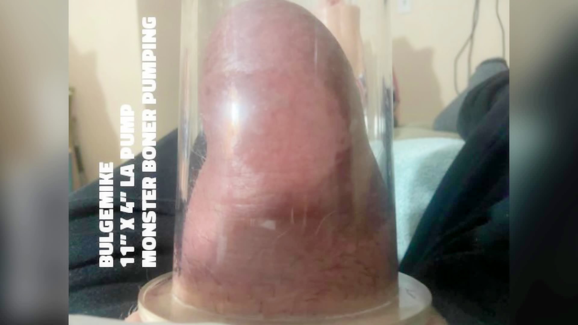 Thumb 14