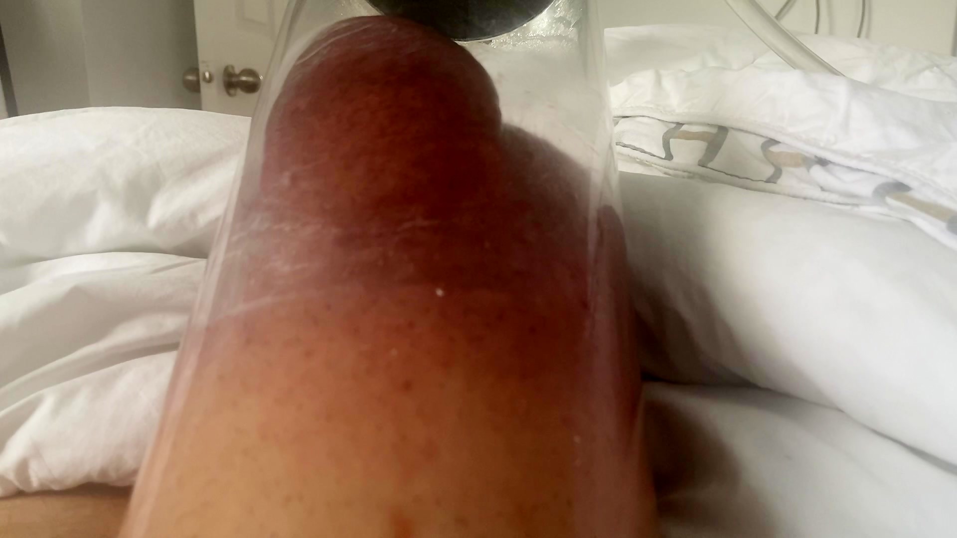 Thumb 20
