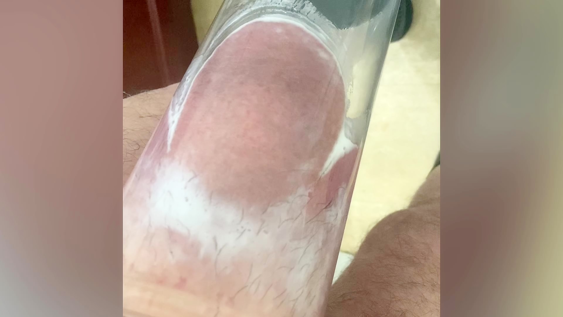 Thumb 6